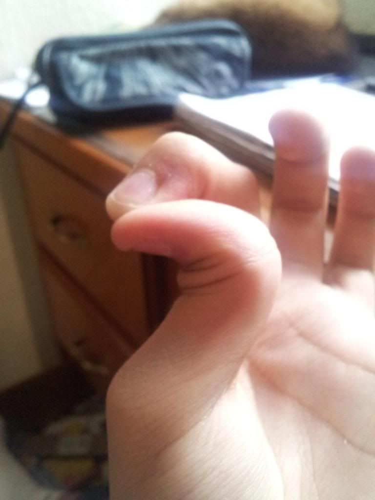 Hitchhiker's Thumb Curse or Gift? Page 2